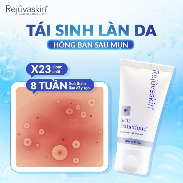 Mụn đi, sẹo đừng ở lại: Khám phá giải pháp Scar Esthetique Mụn đi, sẹo đừng ở lại: Khám phá giải pháp Scar Esthetique