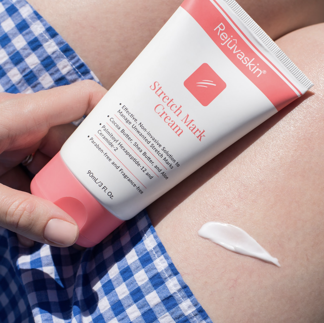 Rạn da không chỉ là chuyện của mẹ bầu!- Ảnh 6. Rạn da không chỉ là chuyện của mẹ bầu!- Ảnh 6.