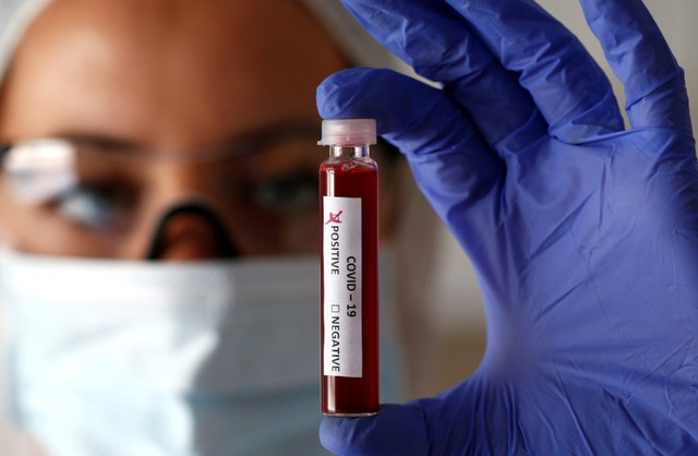 CDC says COVID-19 cases rising in 25 states - Ảnh 1.