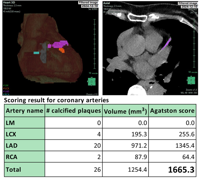 Phát hiện ung thư từ giai đoạn 0: Góc nhìn bác sĩ gần 40 năm kinh nghiệm- Ảnh 2. Phát hiện ung thư từ giai đoạn 0: Góc nhìn bác sĩ gần 40 năm kinh nghiệm- Ảnh 2.