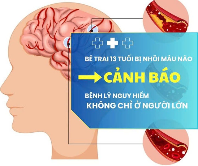 Bé trai 13 tuổi bị nhồi máu não cảnh báo nguy cơ đột qụy ở thiếu niên - Ảnh 1. Bé trai 13 tuổi bị nhồi máu não cảnh báo nguy cơ đột qụy ở thiếu niên - Ảnh 1.