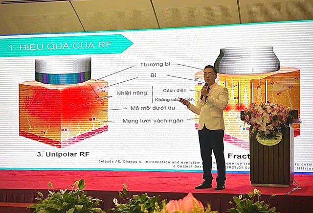 Công nghệ RF: Bằng chứng và ứng dụng trong thẩm mỹ da - Ảnh 3.