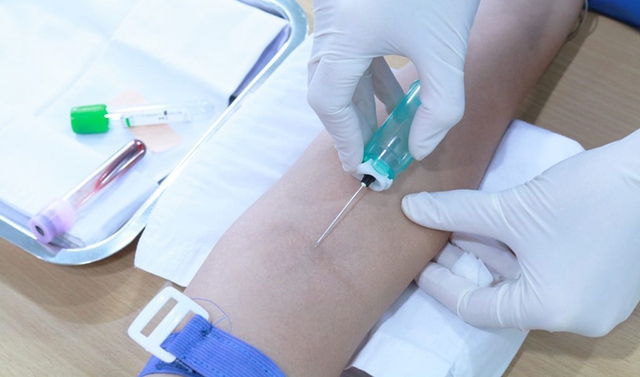 4 yếu tố ‘đặc thù’ làm gia tăng bệnh tim mạch, ung thư tại Việt Nam 4 yếu tố ‘đặc thù’ làm gia tăng bệnh tim mạch, ung thư tại Việt Nam