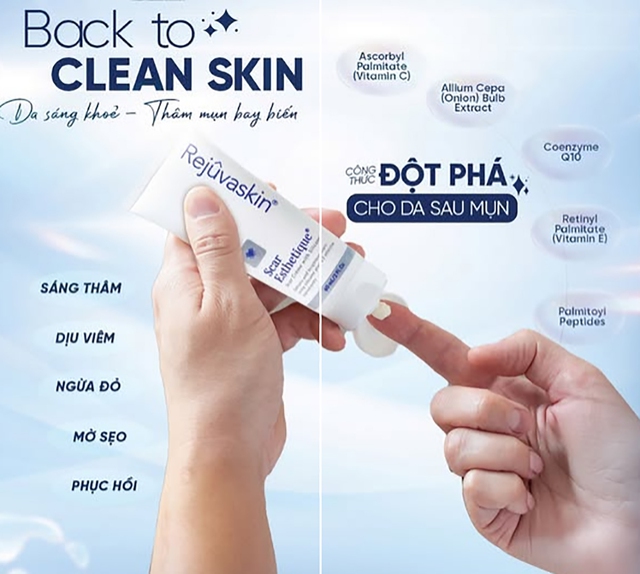 Bật mí cách trị thâm sau khi nặn mụn chuẩn y khoa hiệu quả ngay tại nhà Bật mí cách trị thâm sau khi nặn mụn chuẩn y khoa hiệu quả ngay tại nhà