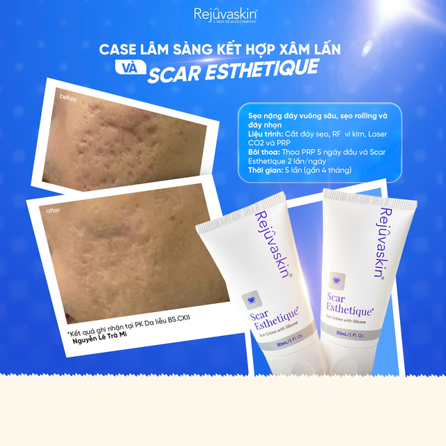 Scar Esthetique - Công thức kích hoạt làn da mới, mờ sẹo, sáng da sau mụn- Ảnh 7.