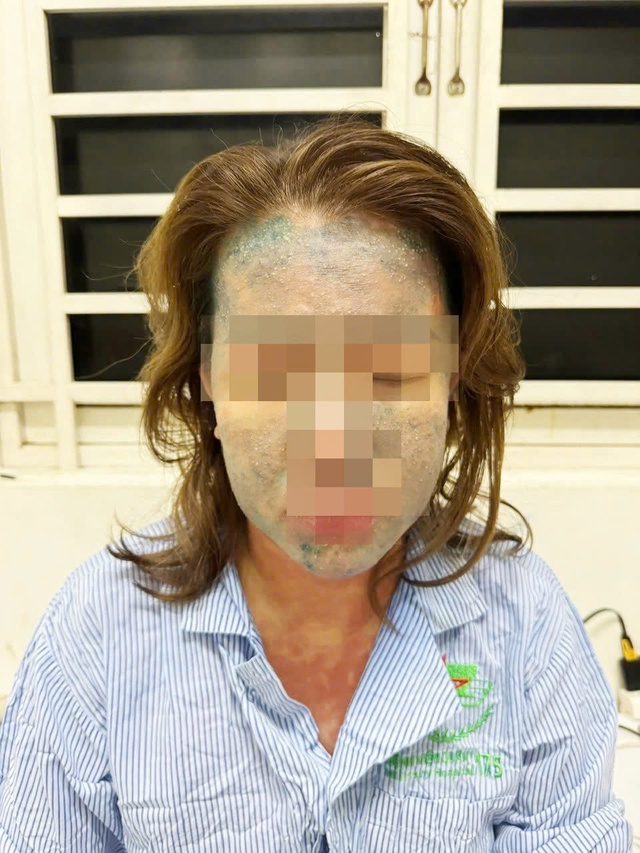 Nguy kịch vì dùng thuốc giảm cân, collagen ‘xách tay’ Nguy kịch vì dùng thuốc giảm cân, collagen ‘xách tay’