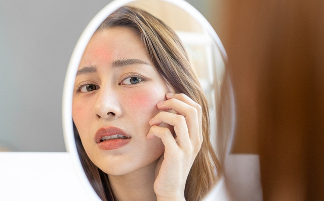 Top 7 sản phẩm làm dịu da đỏ, kích ứng sau laser hiệu quả- Ảnh 1.