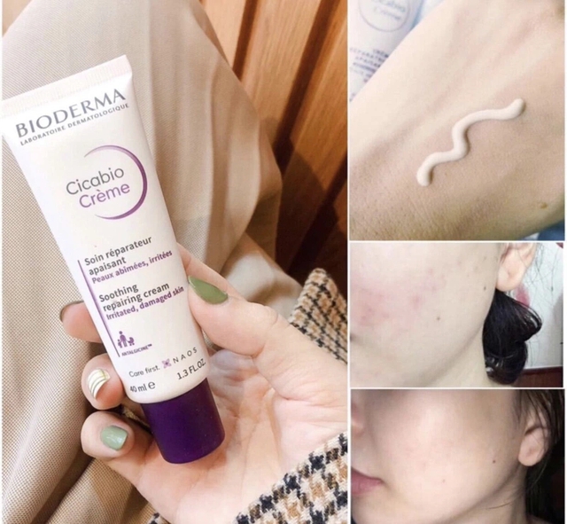 Top 7 sản phẩm làm dịu da đỏ, kích ứng sau laser hiệu quả- Ảnh 11.