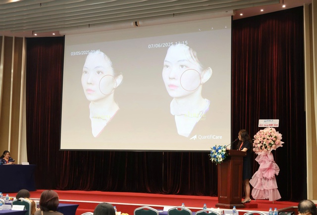 ThS-BS Châu Ngọc Tố Trinh - Dấu ấn chuyên môn tại ICAD Vietnam 2025- Ảnh 2.