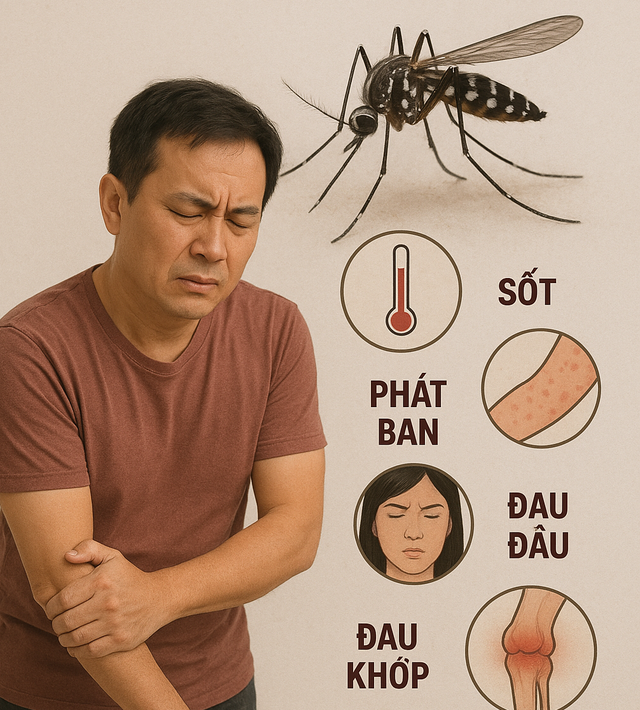 Bác sĩ: Bệnh Chikungunya có nguy hiểm không, lây nhiễm như thế nào? - Ảnh 1.