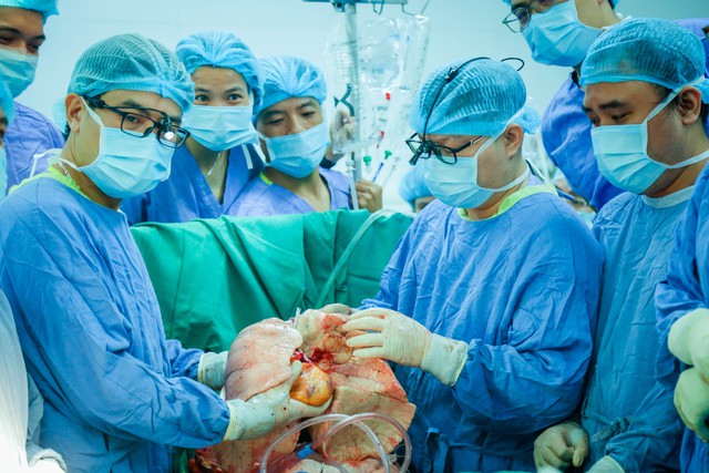 Ca ghép đồng thời tim, phổi đầu tiên thành công tại Việt Nam- Ảnh 1. Ca ghép đồng thời tim, phổi đầu tiên thành công tại Việt Nam- Ảnh 1.