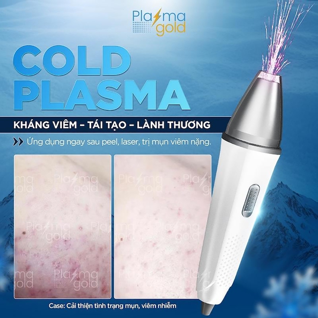 Plasma Gold: Hành trình chinh phục toàn cầu của công nghệ thẩm mỹ đột phá- Ảnh 2.