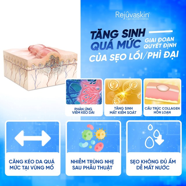 Sẹo lâu năm hay cứng đầu đến mấy cũng mờ hẳn nhờ kem trị sẹo này- Ảnh 6.