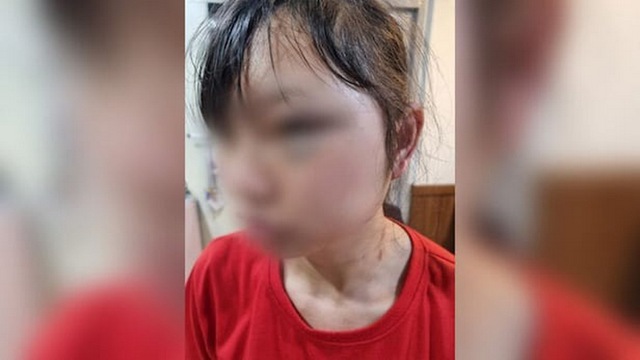 Hàn Quốc tuyên án vụ đánh đập thô bạo một nữ lao động người Việt - Ảnh 1.