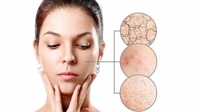 Top kem dưỡng phục hồi được ‘săn đón’ hiện nay- Ảnh 1. Top kem dưỡng phục hồi được ‘săn đón’ hiện nay- Ảnh 1.