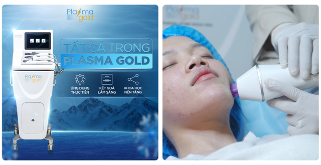 Máy Plasma Gold có tốt không? Giá 1 liệu trình là bao nhiêu? - Ảnh 1.