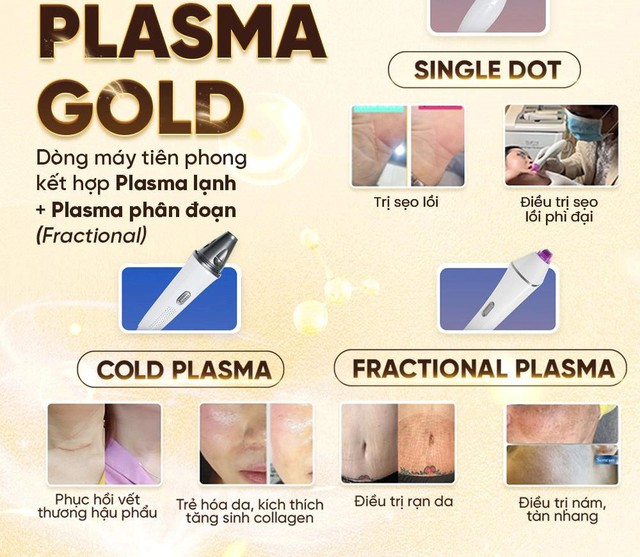 Máy Plasma Gold có tốt không? Giá 1 liệu trình là bao nhiêu? - Ảnh 4.