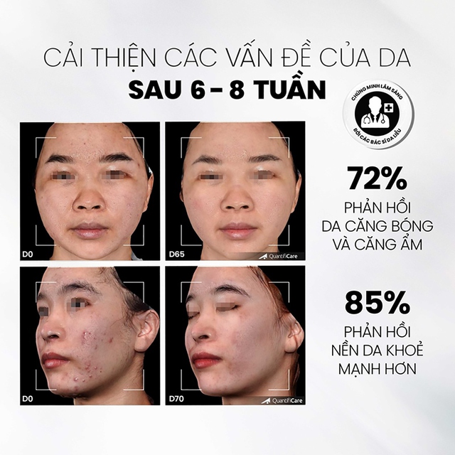 Top 5 tẩy tế bào chết cho da mặt bật tone, top đầu còn căng bóng glowy- Ảnh 3.