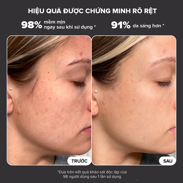 Top 5 tẩy tế bào chết cho da mặt bật tone, top đầu còn căng bóng glowy- Ảnh 7.