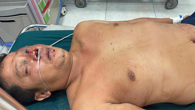 Công an thông tin vụ giúp người gặp tai nạn nhưng lại bị đánh nhập viện- Ảnh 3. Công an thông tin vụ giúp người gặp tai nạn nhưng lại bị đánh nhập viện- Ảnh 3.