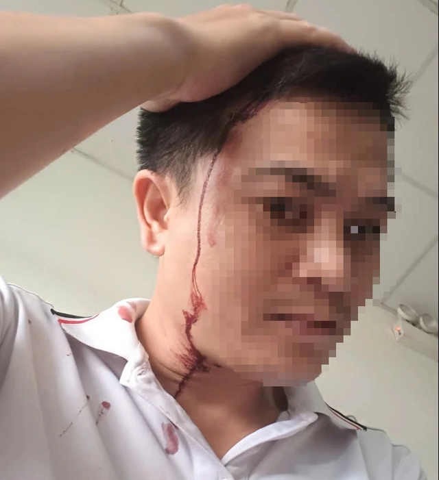 TP.HCM: Nam thanh niên bị người đàn ông tấn công 'vô cớ' trên đường phải nhập viện- Ảnh 2.