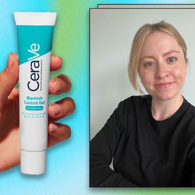 Top 12 kem trị mụn dứt điểm cả mụn thể nặng mà không thâm, không kích ứng - Ảnh 4.