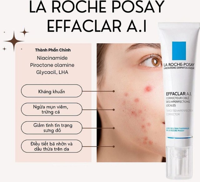 Top 12 kem trị mụn dứt điểm cả mụn thể nặng mà không thâm, không kích ứng - Ảnh 5.