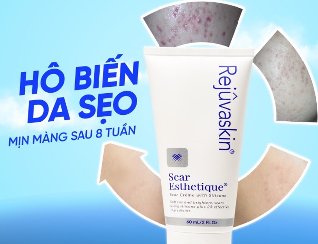 Đừng mắc sai lầm khi chọn kem làm mờ sẹo: Chia sẻ từ chuyên gia da liễu - Ảnh 1.