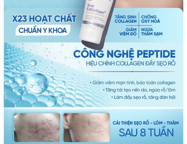 Đừng mắc sai lầm khi chọn kem làm mờ sẹo: Chia sẻ từ chuyên gia da liễu - Ảnh 5.