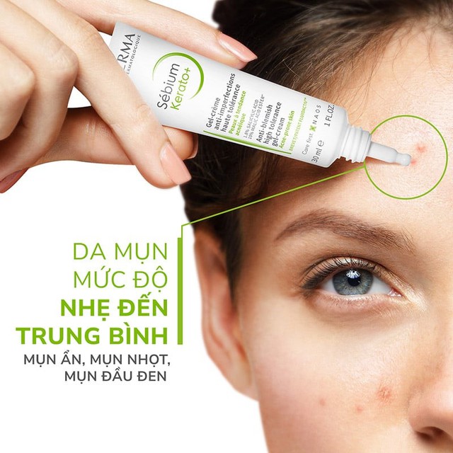 Top 5 kem giảm mụn vi&ecirc;m sưng xẹp nhanh, ngăn t&aacute;i ph&aacute;t v&agrave; ngừa sẹo hiệu quả- Ảnh 7.