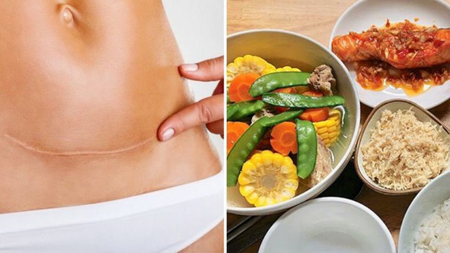 - Ảnh 10. - Ảnh 10.