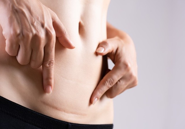 - Ảnh 2. - Ảnh 2.