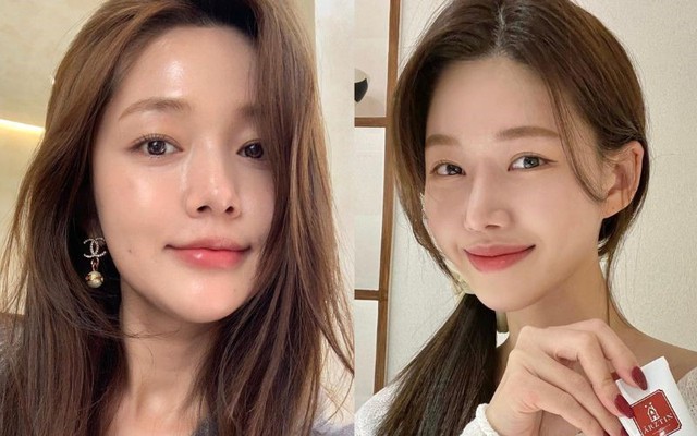 Top 3 kem trắng da chống l&atilde;o h&oacute;a cho tuổi 40 ngược về tuổi sinh học 20- Ảnh 1.