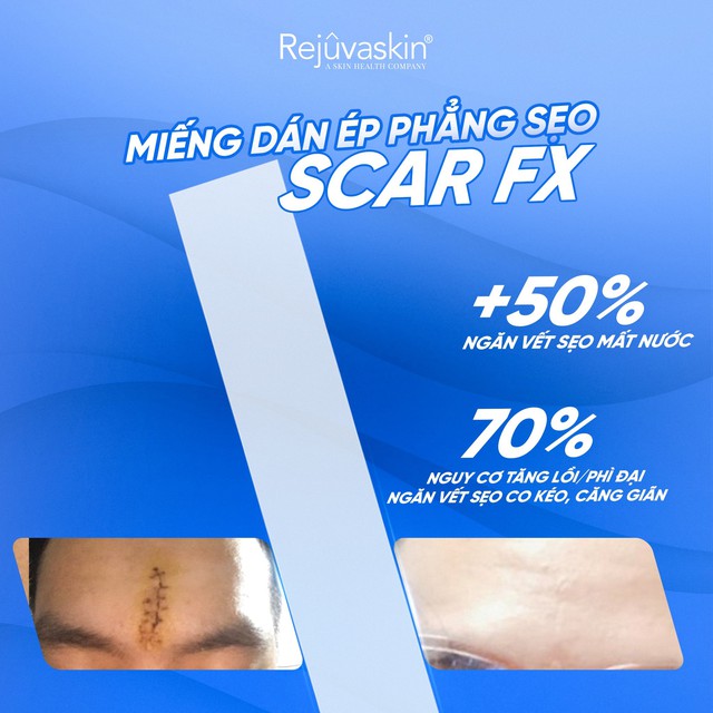 Sẹo lồi: Nguy&ecirc;n nh&acirc;n v&agrave; c&aacute;ch điều trị với cả sẹo l&acirc;u năm, ngừa t&aacute;i ph&aacute;t - Ảnh 11.