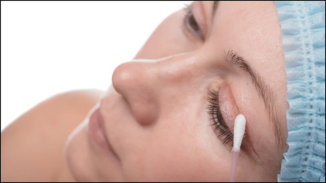 Chia sẻ c&aacute;ch chăm s&oacute;c vết thương sau cắt m&iacute; ngăn ngừa sẹo xấu từ chuy&ecirc;n gia - Ảnh 5.