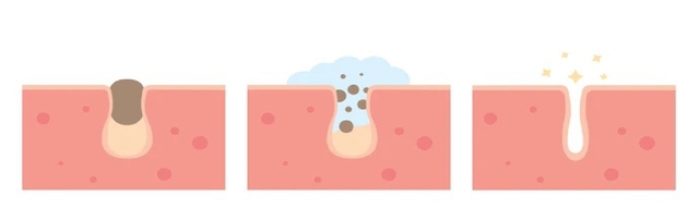 L&agrave;m sạch - Bước đầu ti&ecirc;n quyết định sức khỏe l&agrave;n da- Ảnh 2.