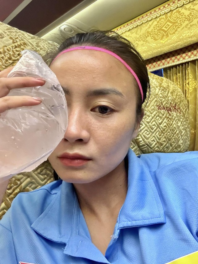 &lsquo;Hot girl&rsquo; đội tuyển nữ Việt Nam chia sẻ khu&ocirc;n mặt bầm t&iacute;m v&igrave; thi đấu, fan x&oacute;t xa- Ảnh 2.