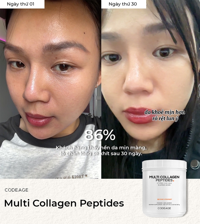 Phụ nữ tuổi 30+ cần phải làm gì ngay để bảo tồn và tăng cường lượng collagen? - Ảnh 1. Phụ nữ tuổi 30+ cần phải làm gì ngay để bảo tồn và tăng cường lượng collagen? - Ảnh 1.