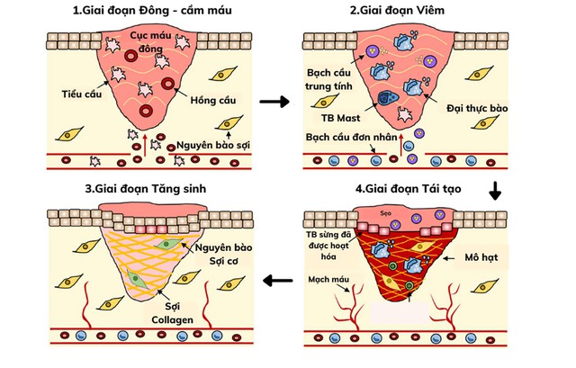 Qu&aacute; tr&igrave;nh l&agrave;nh thương như thế n&agrave;o, phương ph&aacute;p gi&uacute;p phục hồi nhanh ngừa sẹo tối ưu? - Ảnh 4.