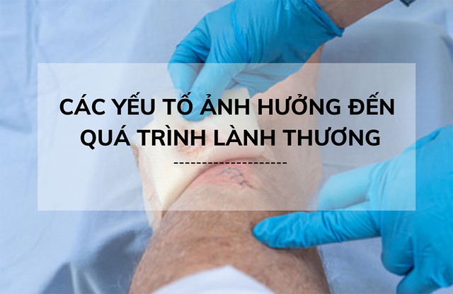 Qu&aacute; tr&igrave;nh l&agrave;nh thương như thế n&agrave;o, phương ph&aacute;p gi&uacute;p phục hồi nhanh ngừa sẹo tối ưu? - Ảnh 5.