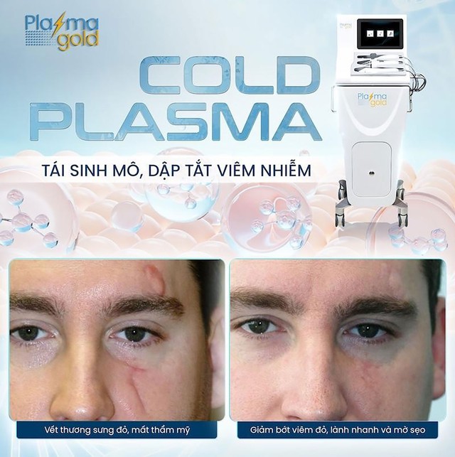 Plasma Gold khẳng định vai trò tiên phong trong công nghệ Plasma làm đẹp và lành thương- Ảnh 3. Plasma Gold khẳng định vai trò tiên phong trong công nghệ Plasma làm đẹp và lành thương- Ảnh 3.
