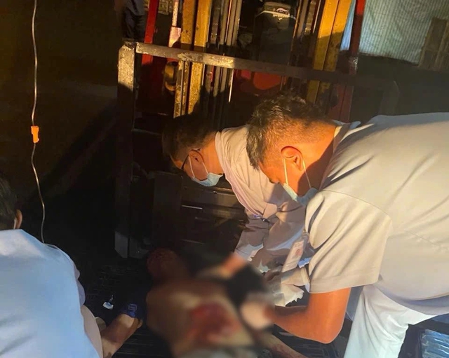 TP.HCM: Bị m&aacute;y xay thịt 'nuốt chửng' tay, phải đưa cả người v&agrave; m&aacute;y v&agrave;o ph&ograve;ng mổ- Ảnh 2.