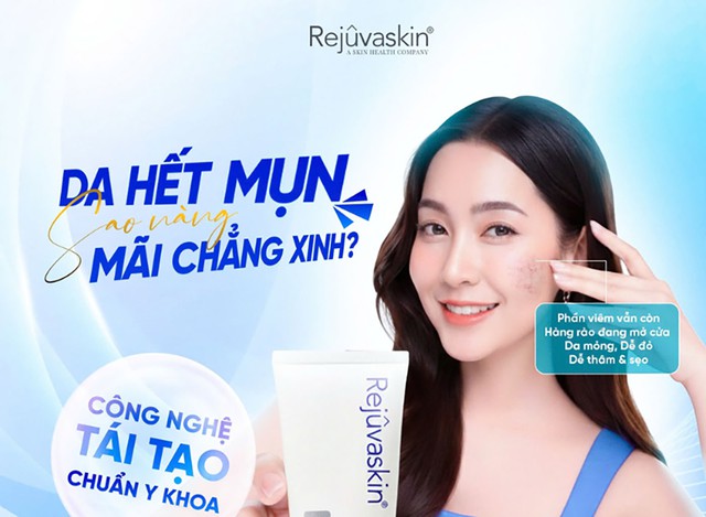 Phục hồi da sau nặn mụn để hạn chế sẹo - Điều nhiều người đang bỏ qua- Ảnh 1.