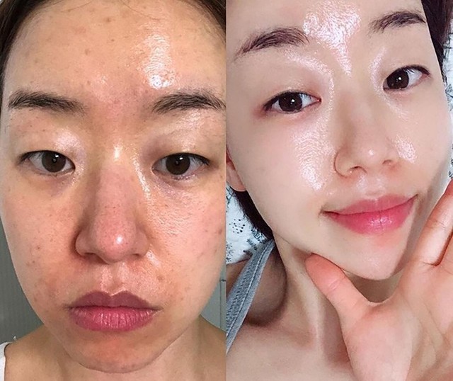 Top 8 kem trắng da chống l&atilde;o h&oacute;a đang được chị em 'săn l&ugrave;ng' trước Tết - Ảnh 1.