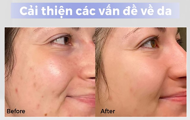 Top 8 kem trắng da chống l&atilde;o h&oacute;a đang được chị em 'săn l&ugrave;ng' trước Tết - Ảnh 5.