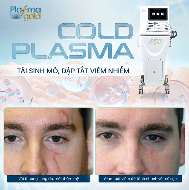 H&eacute; lộ gi&aacute; m&aacute;y Plasma Lạnh: Spa, thẩm mỹ viện c&oacute; đ&aacute;ng để đầu tư kh&ocirc;ng? - Ảnh 3.
