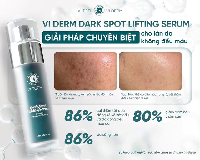 Top 3 serum tranexamic acid giúp mờ nám sạm sau 4 tuần dù námchân sâu, lâu năm - Ảnh 2.