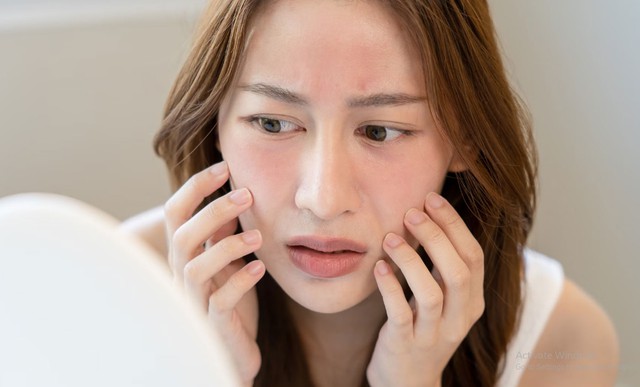 Cách dùng mặt nạ dưỡng da tưởng càng đắp càng đẹp, ai ngờ ngược lại- Ảnh 2. Cách dùng mặt nạ dưỡng da tưởng càng đắp càng đẹp, ai ngờ ngược lại- Ảnh 2.