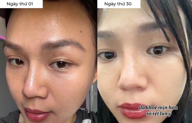 Cảnh b&aacute;o: Bổ sung collagen sai thời điểm, da kh&ocirc;ng căng trẻ m&agrave; c&ograve;n l&atilde;o h&oacute;a nhanh- Ảnh 1.