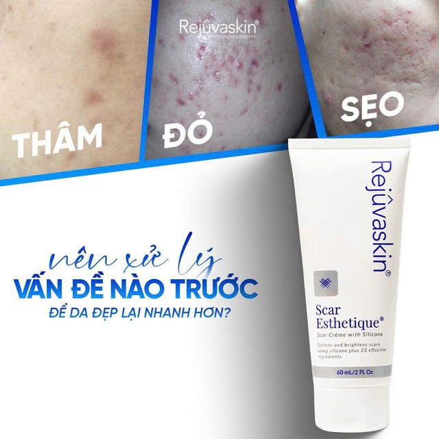 Da mụn breakout: khi nào nên chăm sóc da, khi nào nên đi thẳng đến treatment?- Ảnh 1. Da mụn breakout: khi nào nên chăm sóc da, khi nào nên đi thẳng đến treatment?- Ảnh 1.